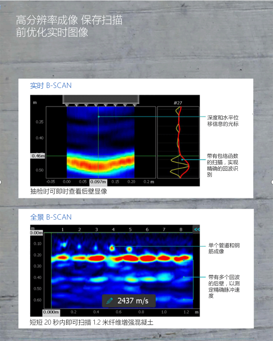 超聲成像掃描儀優勢